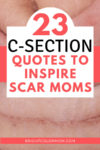 C-section quotes pin image
