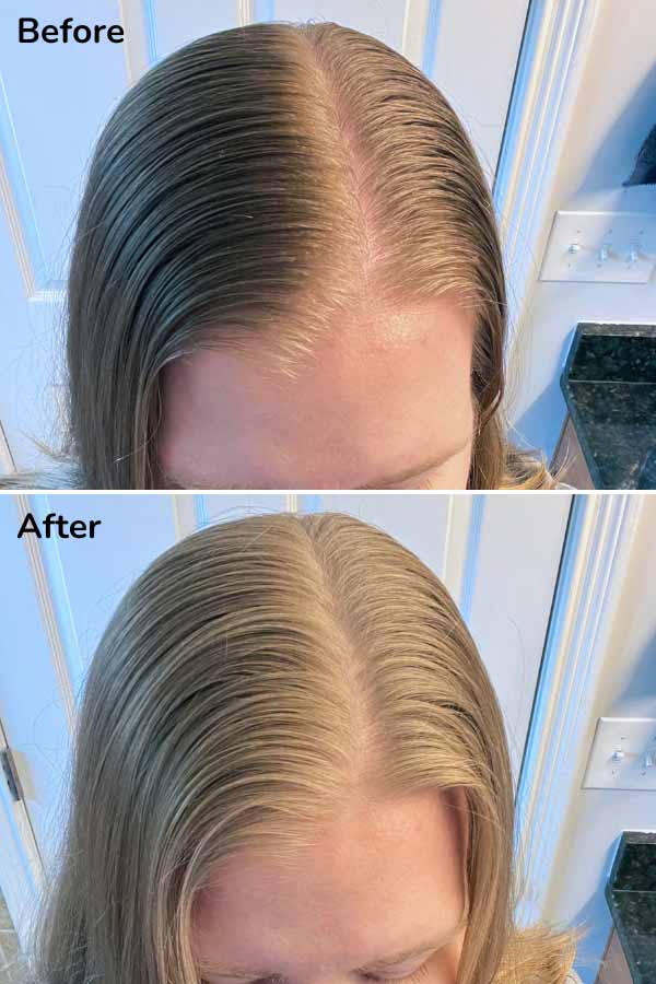before and after photos, top with oily hair, bottom after Equate dry shampoo has been applied